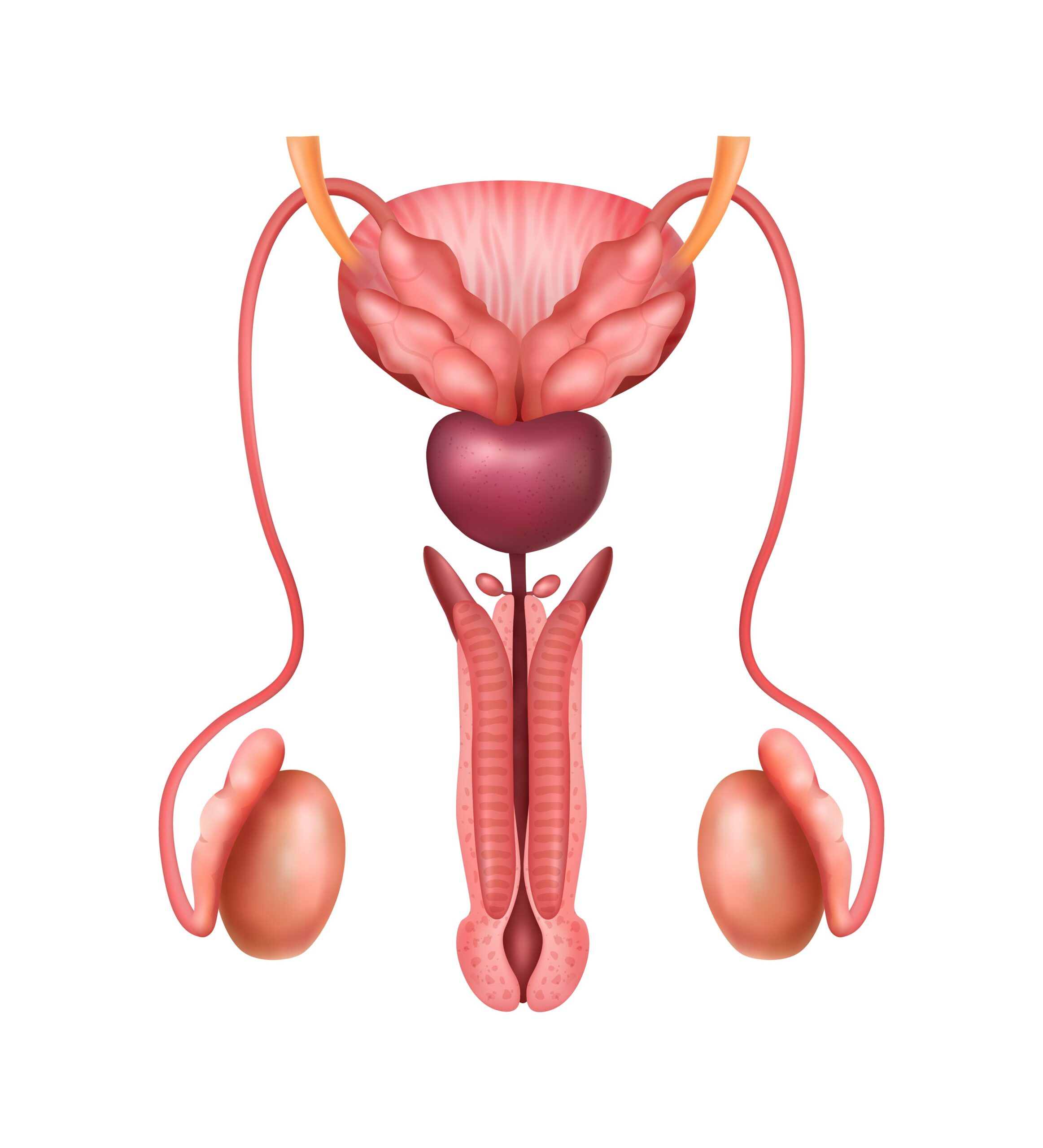 Urethral Stricture: Symptoms, Causes, Treatment & Prevention