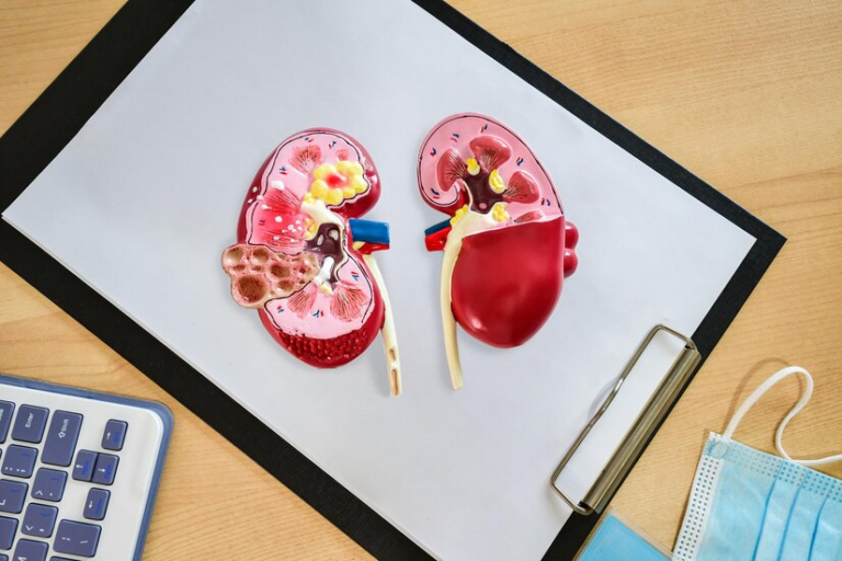 Percutaneous Nephrolithonomy